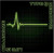 Type O Negative • Life Is Killing Me / 20th Anniversary Edition / Green & Black Vinyl (3LP)